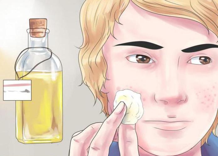 Antibiotika gegen die Pickel im Gesicht Bewertungen