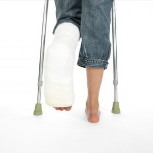 ankle fracture how long to wear a cast after surgery