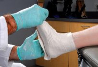 Ankle fracture: how to walk in the cast (offset)