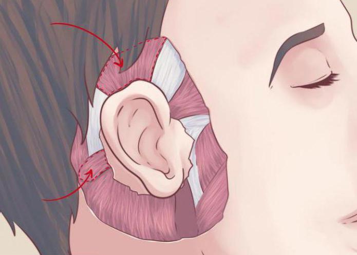कान मांसपेशियों