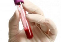 Choroba anemia - co to jest?