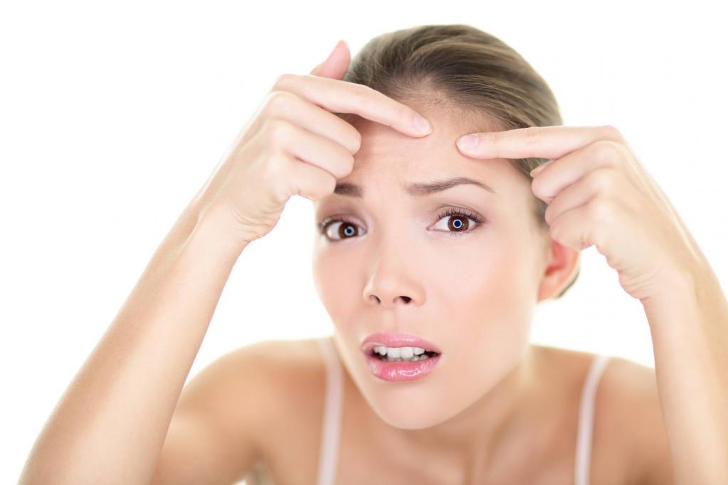 कैसे करने के लिए सुरक्षित रूप से pimples निचोड़