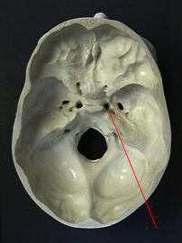 o que passa na irregulares abertura do crânio