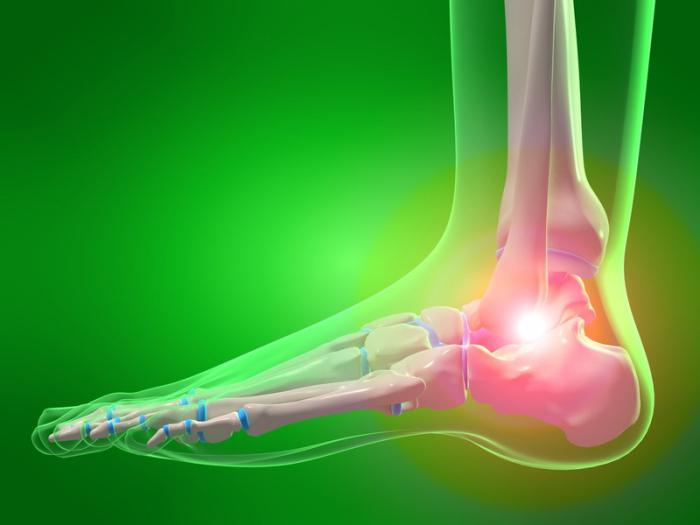 osteoartrit, ayak bileği belirtileri ve tedavisi