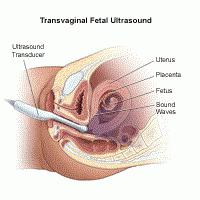 tempo de ultra-som durante a gravidez