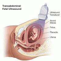 3 ultrasound time