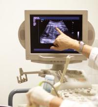 2 ultrason süresi