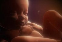 胎盘前壁的子宫：一个令人关注的问题或一个正常的变体?