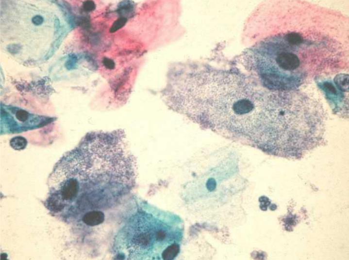 Bakterium unter dem Mikroskop