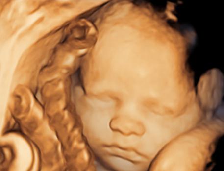 ultrasound 30 weeks