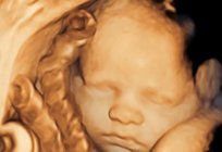 30 hafta kaç ay? 30. hafta: fetüs gelişimi