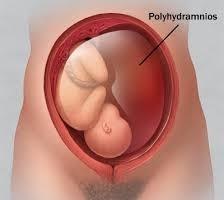 胎儿缺氧症状