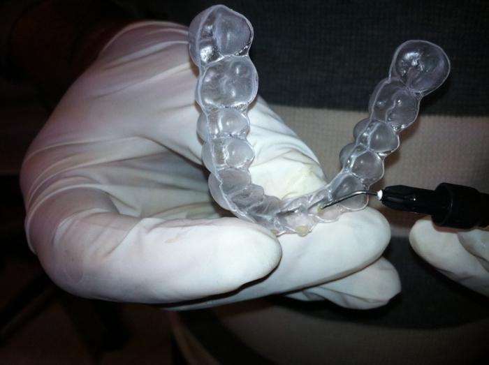 ortodoncja korekcji zgryzu