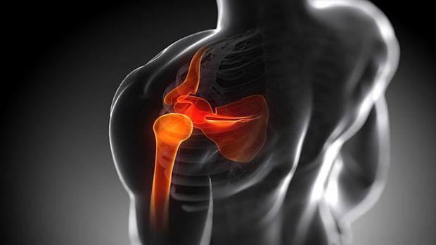 la osteoartritis de la articulación del hombro el tratamiento de la gimnasia