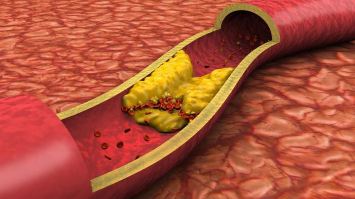 a taxa de colesterol no sangue em mulheres após os 50 anos de um dedo