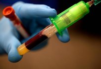 Leukopenia to poważnie: jak rozpoznać i leczyć niebezpieczną chorobę krwi?