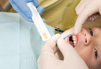氟化的牙齿-这是什么？ 如何为该过程的深氟的牙齿？