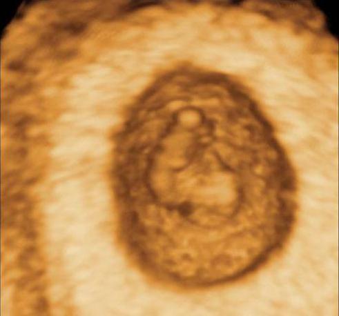 gravidez de 6 semanas o tamanho do feto