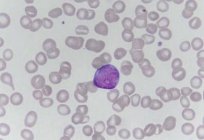 Leukocyty w rozmaz: norma u kobiet i odchylenia