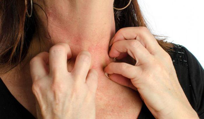 alergia do adesivo na pele