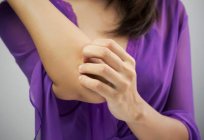 Allergie gegen Pflaster: Symptome und Behandlung