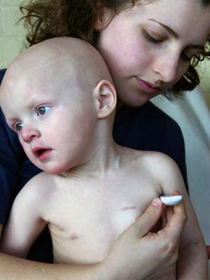 signs of leukemia in children 