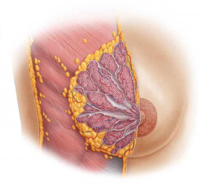 дисгормональные doença de peito