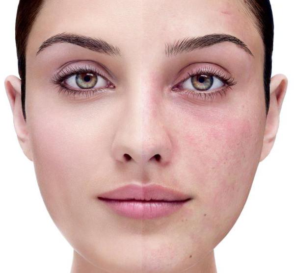 аскорутин dla skóry twarzy od plam starczych