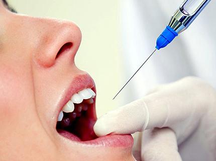 Ultrakain en odontología los clientes