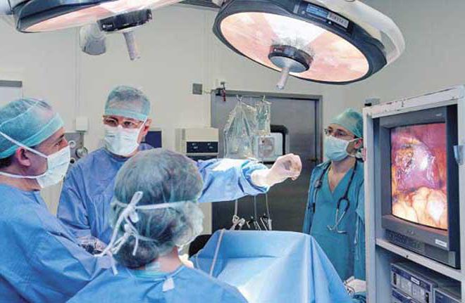 laparoskopia rury przy ciąży pozamacicznej