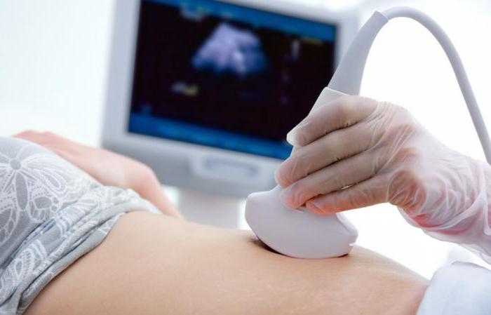 Ultraschalluntersuchung der Gebärmutter und der Eierstöcke Wann ist es besser zu tun
