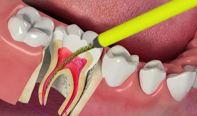 зачем зубу қажет нерв