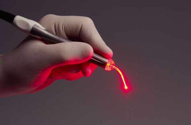 urządzenie kwantowej terapii witeź niż wymienić laser