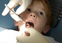 如何区分一牙从一个根源中一个孩子？