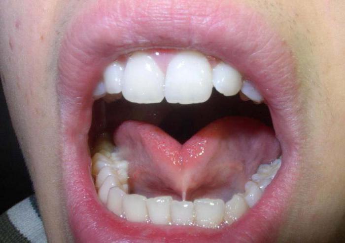die Anatomie der Mundhöhle