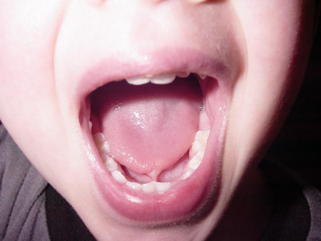la anatomía de la cavidad de la boca de un hombre