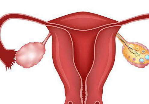 Eierstock zieht vor der Menstruation