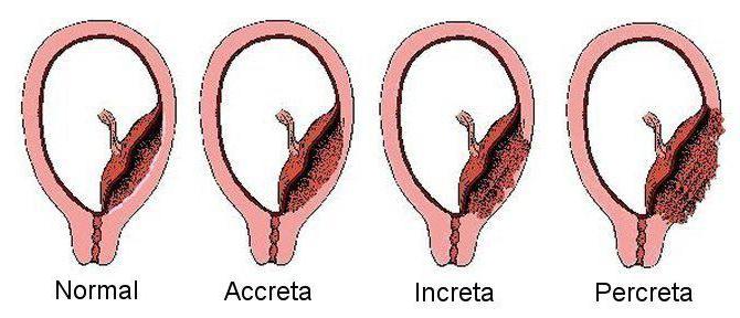 Unterseite des Uterus