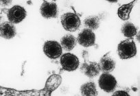 生殖器疱疹：症状、诊断、治疗