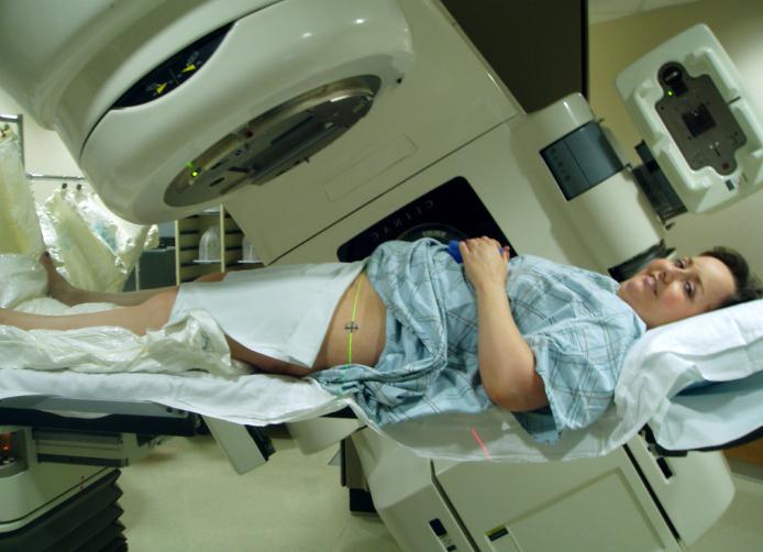la radioterapia de los tumores