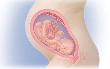 umiarkowane многоводие w ciąży