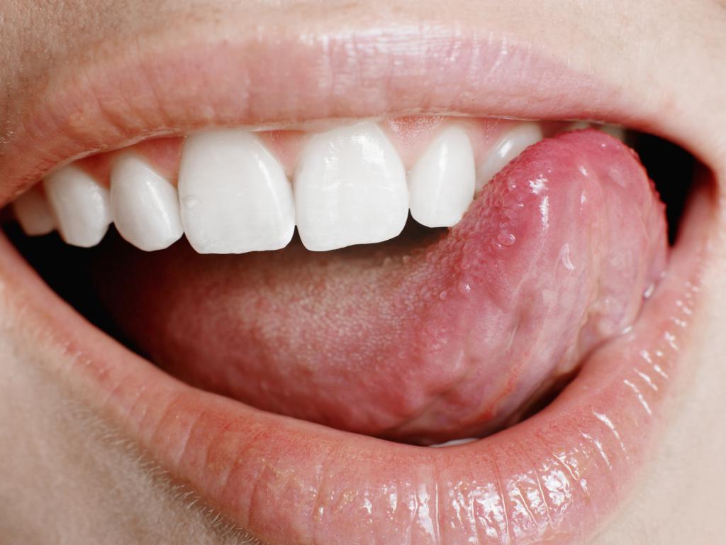 潰瘍の舌