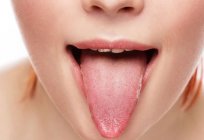ニキビの舌:原因や治療