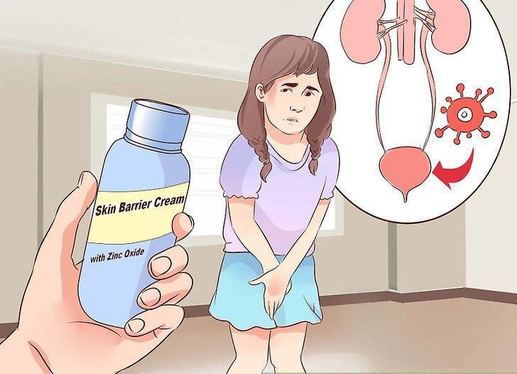 how to cure cystitis