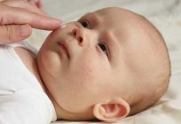 Toxische Erythem Neugeborenen: Ursachen, Behandlung