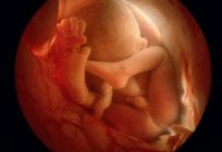 How does a baby develop in the womb? What does the baby feel and what does he do in his mother's stomach?