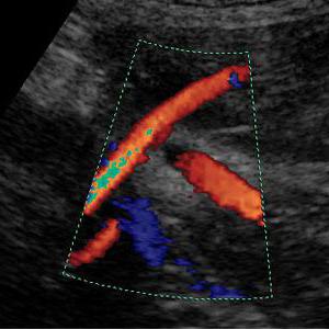 Ultraschall Doppler auf welchem Stadium der Schwangerschaft