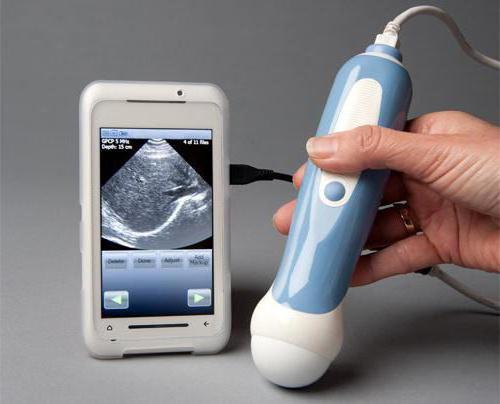 wie machen die Doppler-Sonographie in der Schwangerschaft