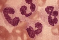 La leucocitosis en sangre: signo de la enfermedad?