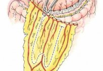 Große Netz: Anatomie, Pathologie, Behandlung